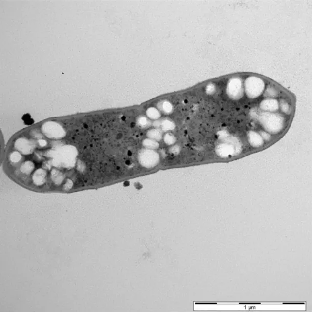 TEM-Aufnahme von Acetobacterium woodii [p83_PHB_Scaceti] (recombinant derivative of DSM 1030)
