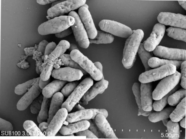 REM-Aufnahme von Clostridium butyricum YF1
