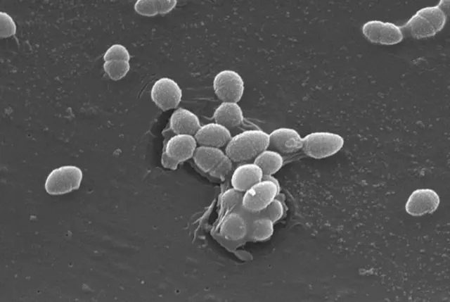 REM-Aufnahme von Enterococcus faecalis