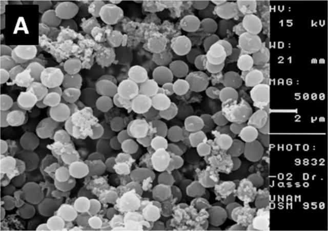 REM-Aufnahme von Methanosarcina acetivorans C2A (DSM 2834)