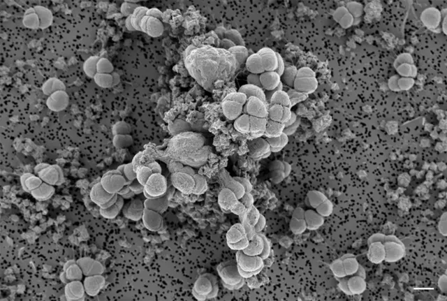 REM-Aufnahme von Methanosarcina barkeri strain Fusaro