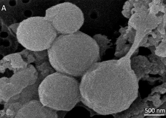 REM-Aufnahme von Moorella thermoacetica ATCC 39073