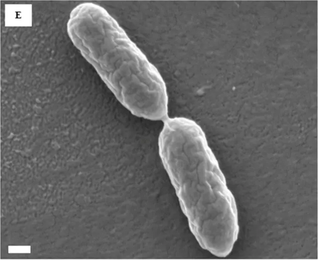 REM-Aufnahme von P. aeruginosa PA14