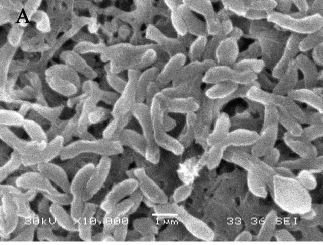 REM-Aufnahme von Rhodopseudomonas palustris strain N
