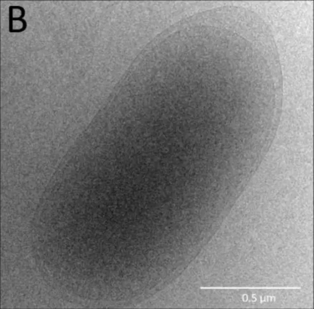 Kryo-EM-Aufnahme von Thauera aminoaromatica MZ1T