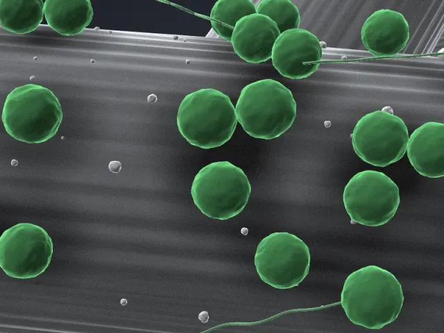3D-Illustration von Methanococcus maripaludis S2 im REM-Stil